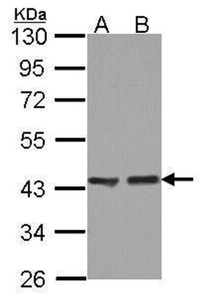 ACAA1 Antibody in Western Blot (WB)