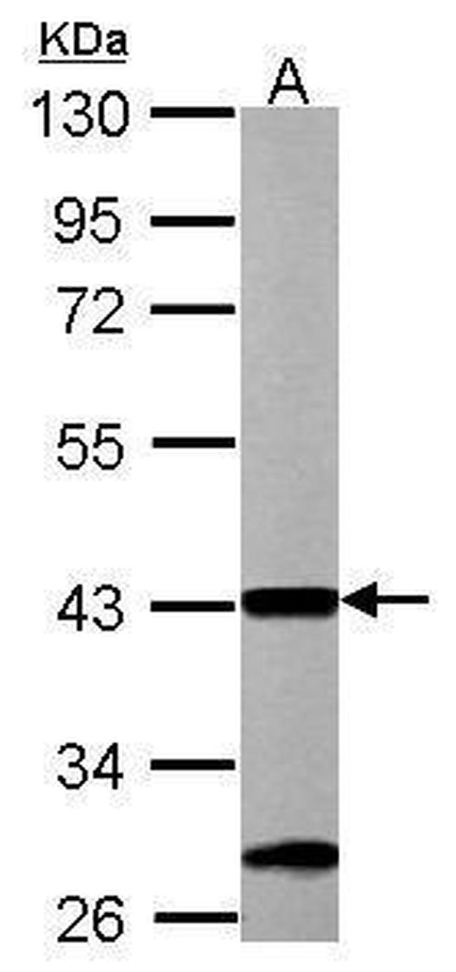 ACAA1 Antibody in Western Blot (WB)