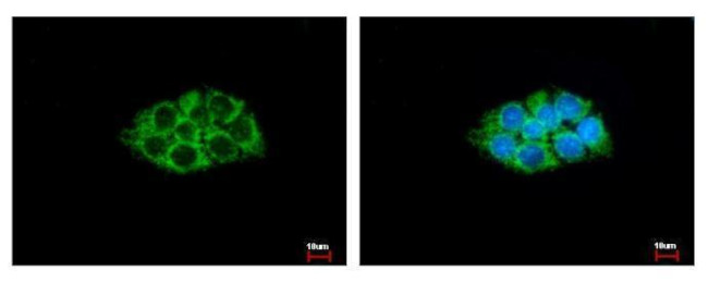 ACAA1 Antibody in Immunocytochemistry (ICC/IF)