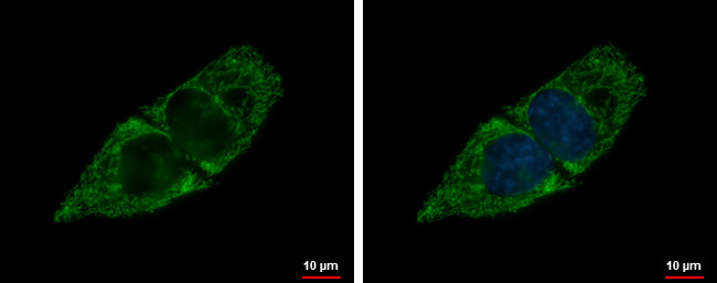 SBCAD Antibody in Immunocytochemistry (ICC/IF)