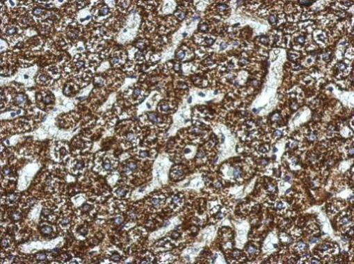 SBCAD Antibody in Immunohistochemistry (Paraffin) (IHC (P))