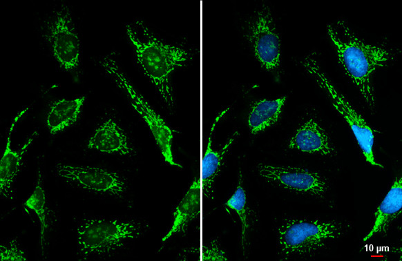 ACADVL Antibody in Immunocytochemistry (ICC/IF)