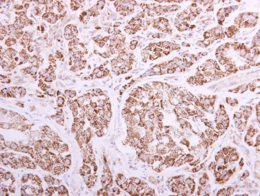 ACADVL Antibody in Immunohistochemistry (Paraffin) (IHC (P))