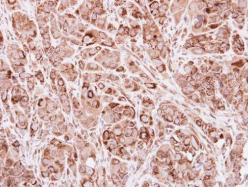 ACADVL Antibody in Immunohistochemistry (Paraffin) (IHC (P))