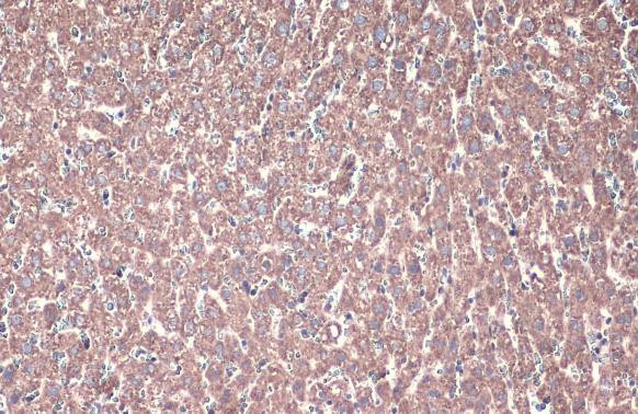 ACADVL Antibody in Immunohistochemistry (Paraffin) (IHC (P))