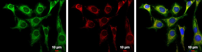 Aconitase 2 Antibody in Immunocytochemistry (ICC/IF)