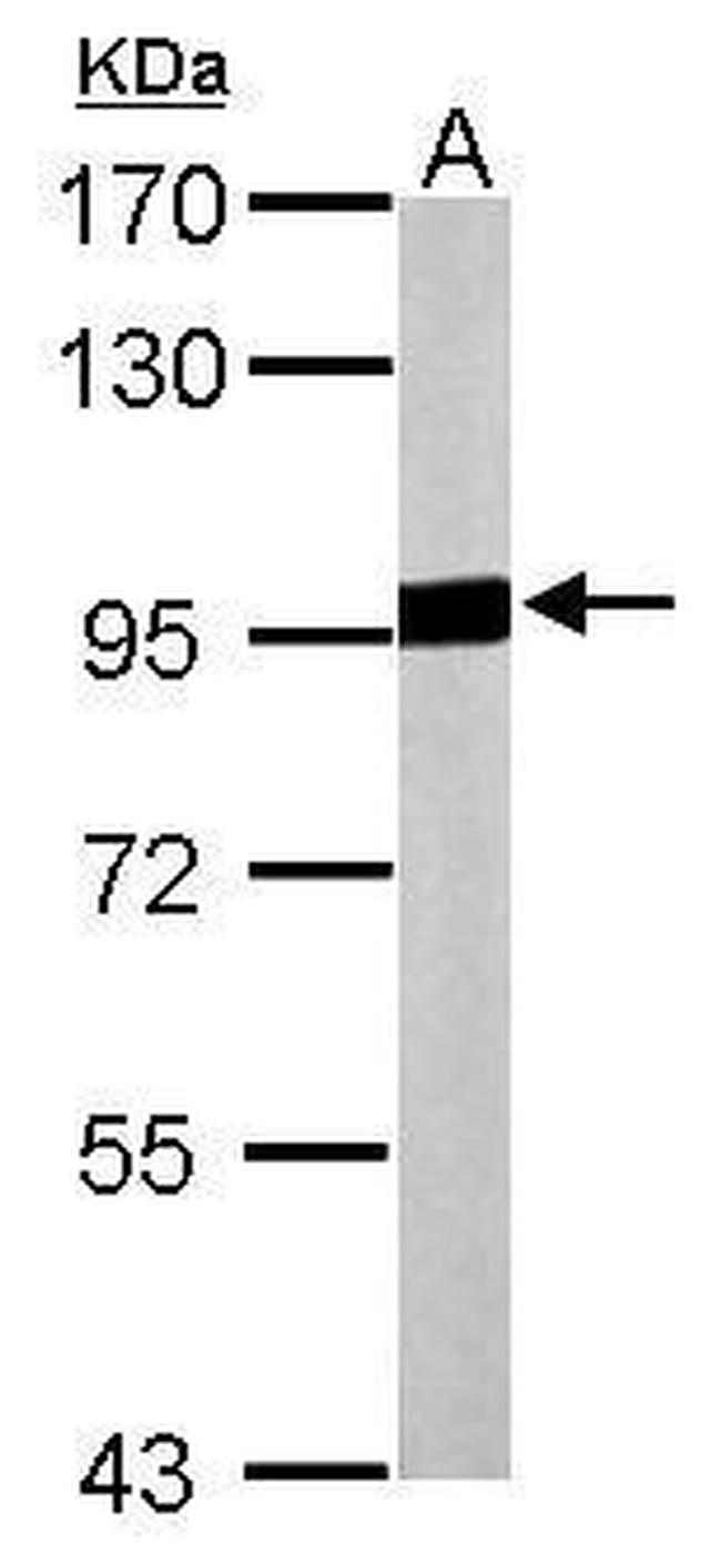 Aconitase 2 Antibody in Western Blot (WB)