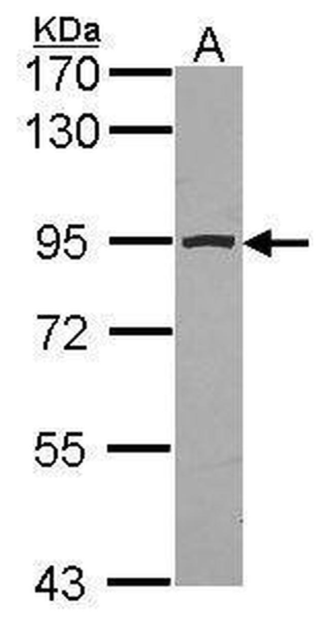 Aconitase 2 Antibody in Western Blot (WB)