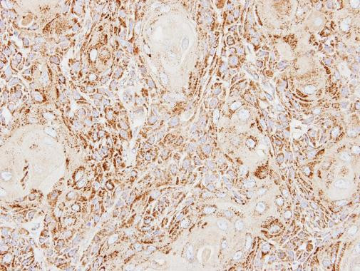 Acid Phosphatase 2 Antibody in Immunohistochemistry (Paraffin) (IHC (P))