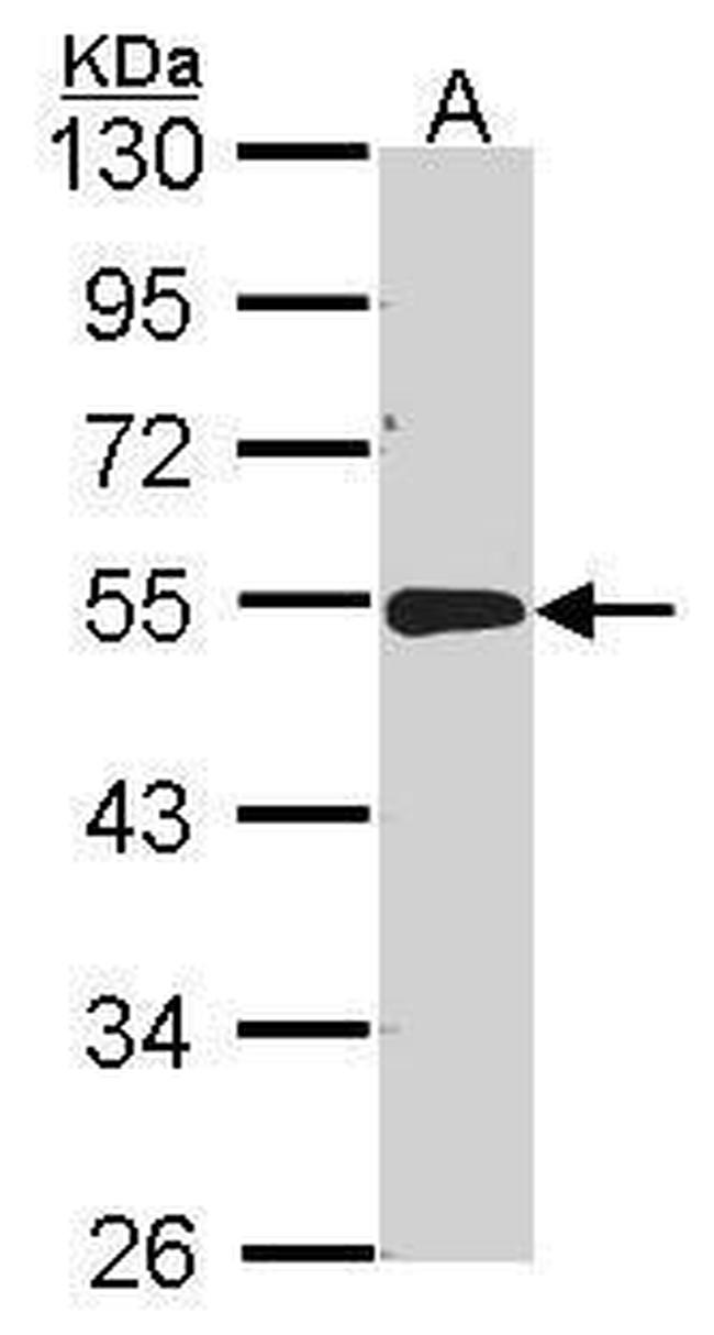 Acid Phosphatase 2 Antibody in Western Blot (WB)