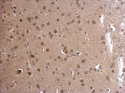 ADSL Antibody in Immunohistochemistry (Paraffin) (IHC (P))