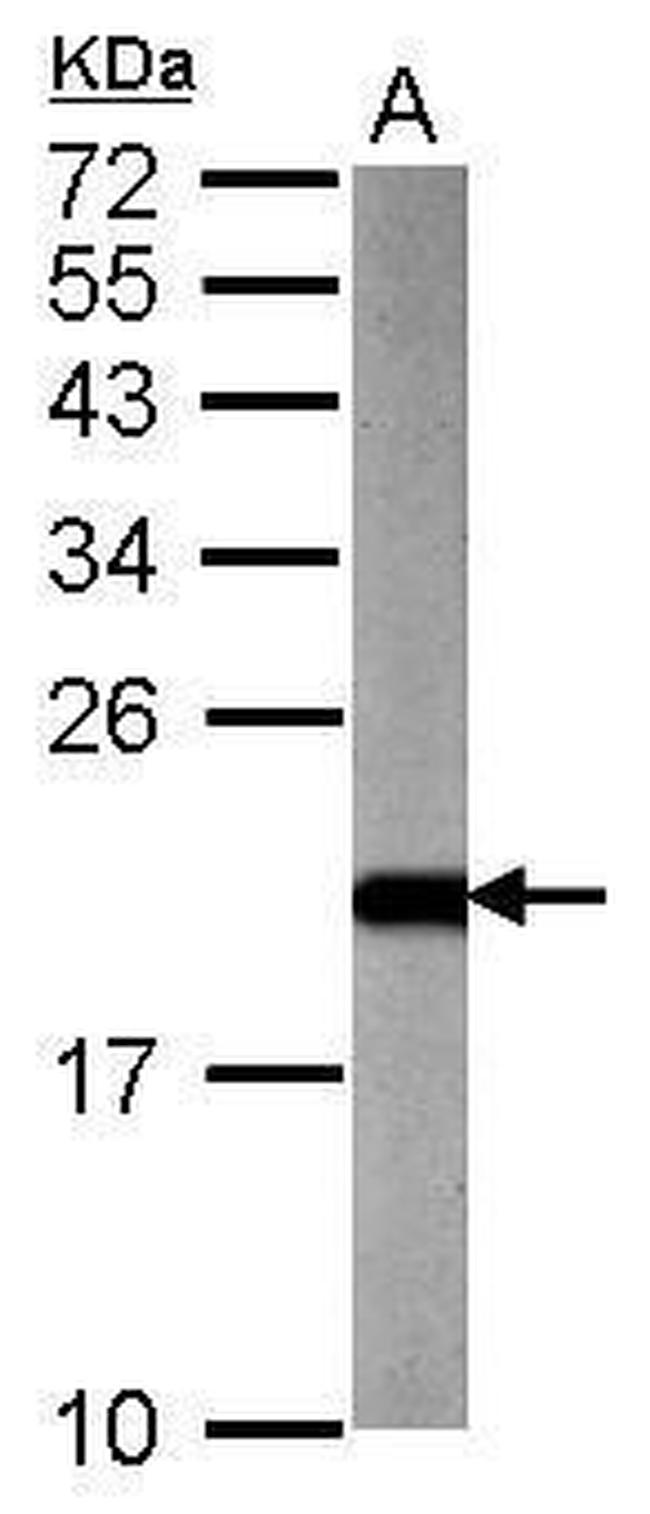 ARF3 Antibody in Western Blot (WB)