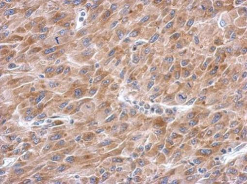 Asparagine Synthetase Antibody in Immunohistochemistry (Paraffin) (IHC (P))