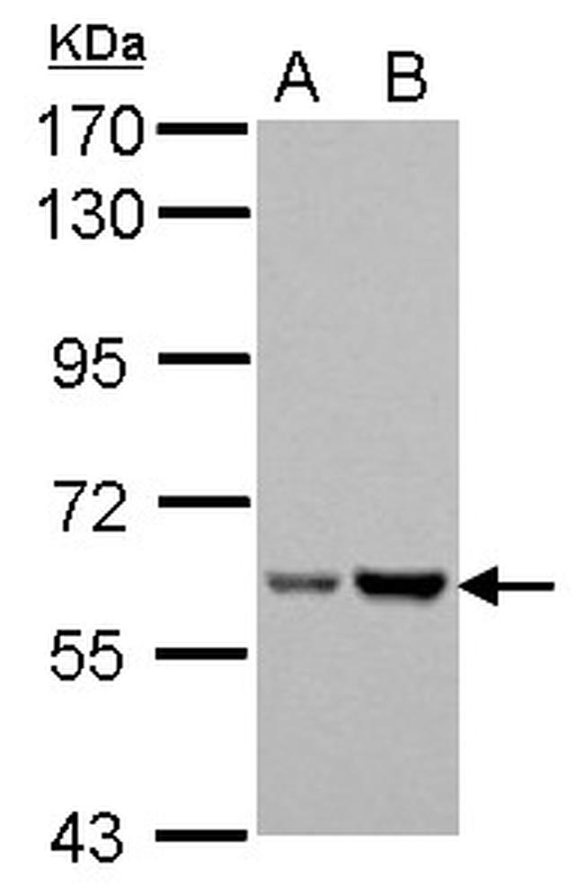 Asparagine Synthetase Antibody in Western Blot (WB)