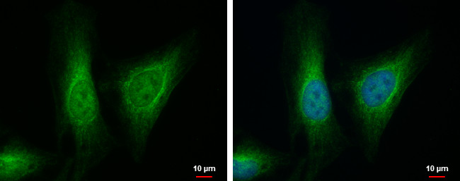 ALDH7A1 Antibody in Immunocytochemistry (ICC/IF)