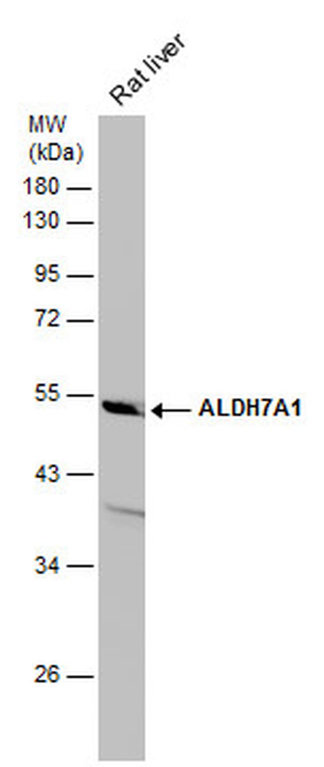 ALDH7A1 Antibody in Western Blot (WB)