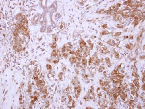 CHAD Antibody in Immunohistochemistry (Paraffin) (IHC (P))