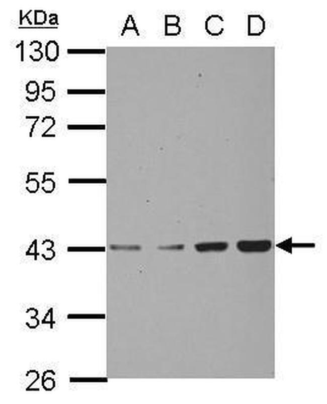 CHAD Antibody in Western Blot (WB)