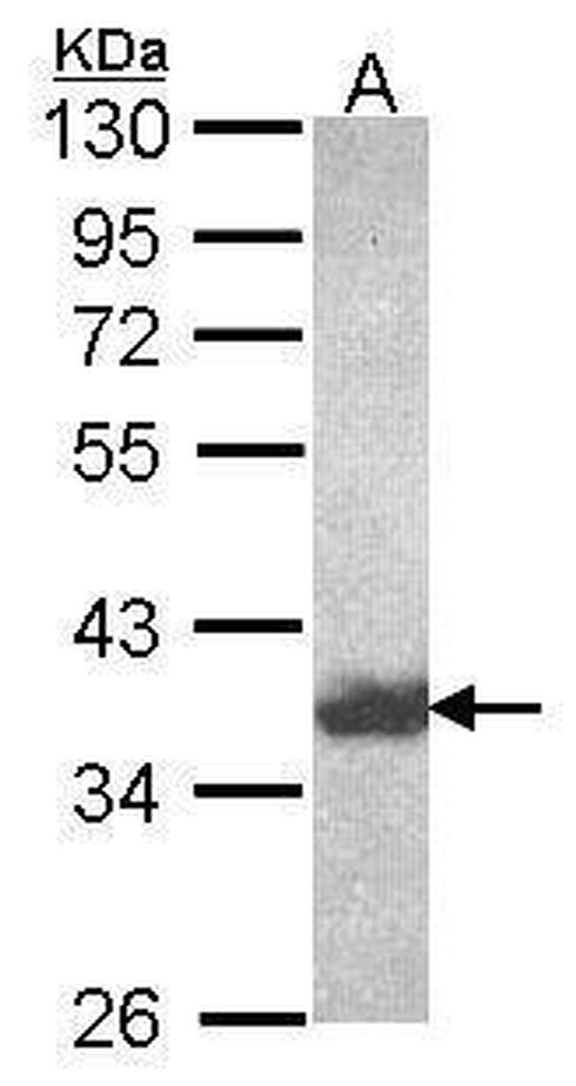 AKR1C4 Antibody in Western Blot (WB)