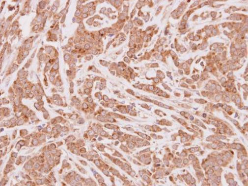 CPT1A Antibody in Immunohistochemistry (Paraffin) (IHC (P))