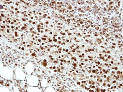 CSTF1 Antibody in Immunohistochemistry (Paraffin) (IHC (P))