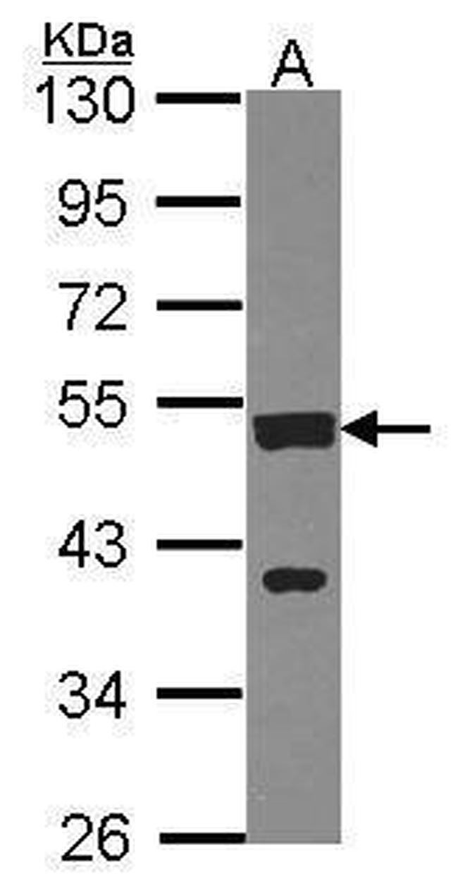 CSTF1 Antibody in Western Blot (WB)