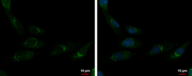 CUX1/Protein CASP Antibody in Immunocytochemistry (ICC/IF)