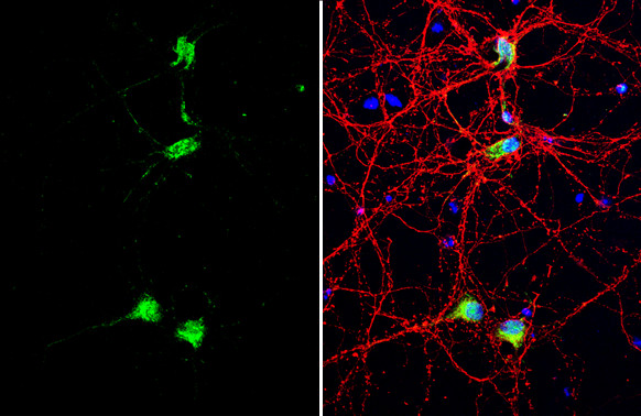 CUX1/Protein CASP Antibody in Immunocytochemistry (ICC/IF)