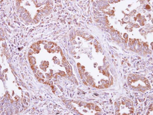 DARS Antibody in Immunohistochemistry (Paraffin) (IHC (P))