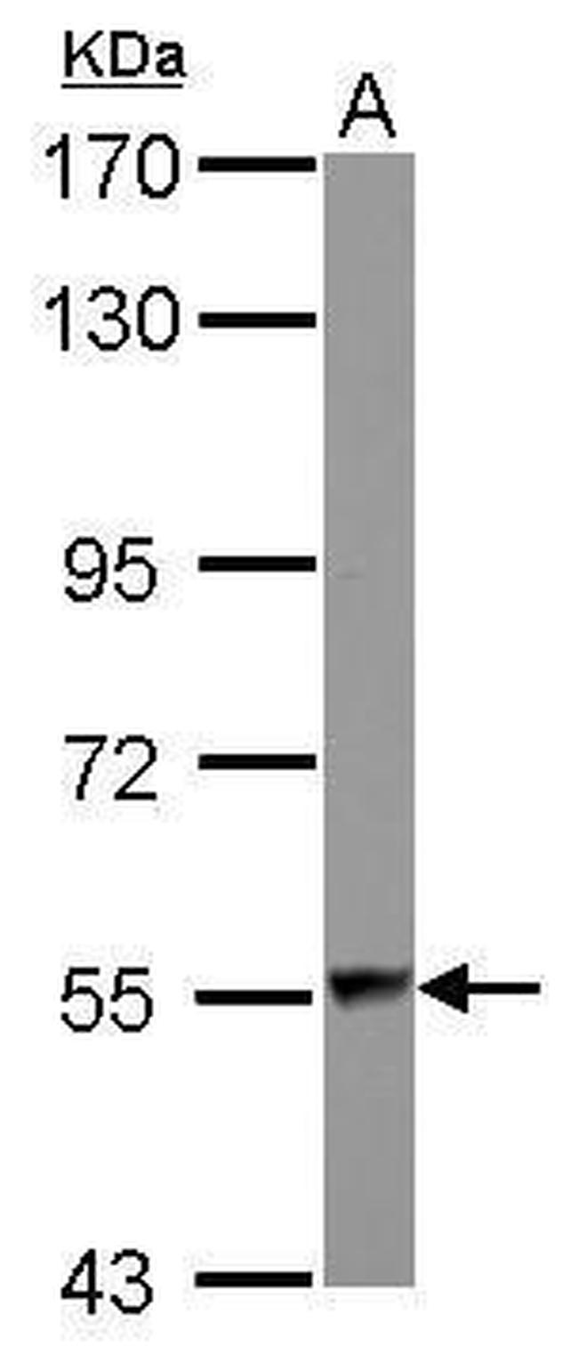 DARS Antibody in Western Blot (WB)