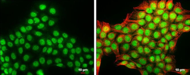 DNASE1L3 Antibody in Immunocytochemistry (ICC/IF)