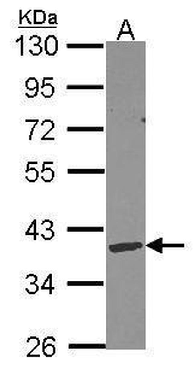 DNASE1L3 Antibody in Western Blot (WB)