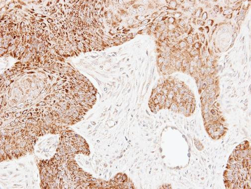 ECH1 Antibody in Immunohistochemistry (Paraffin) (IHC (P))