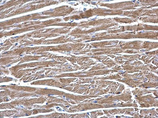 ECHS1 Antibody in Immunohistochemistry (Paraffin) (IHC (P))