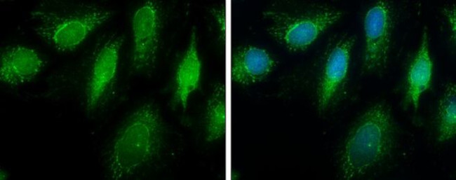 ECHS1 Antibody in Immunocytochemistry (ICC/IF)