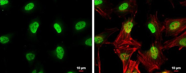 ETV5 Antibody in Immunocytochemistry (ICC/IF)