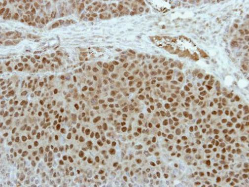 ETV5 Antibody in Immunohistochemistry (Paraffin) (IHC (P))