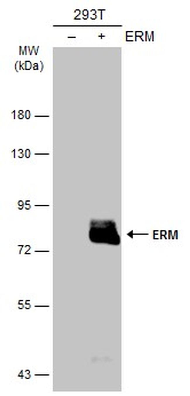 ETV5 Antibody in Western Blot (WB)