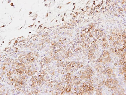 EXTL2 Antibody in Immunohistochemistry (Paraffin) (IHC (P))