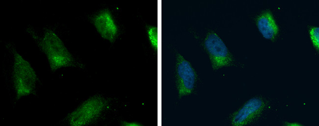 ACSL4 Antibody in Immunocytochemistry (ICC/IF)