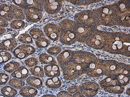 ACSL4 Antibody in Immunohistochemistry (Paraffin) (IHC (P))