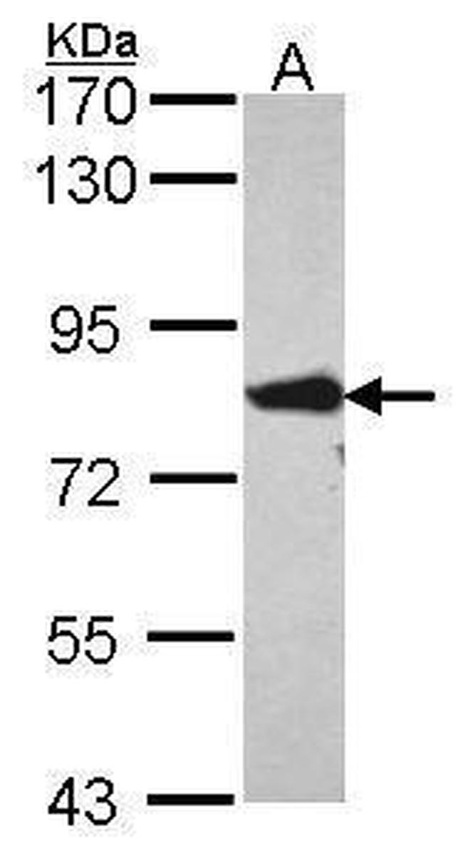 ACSL4 Antibody in Western Blot (WB)