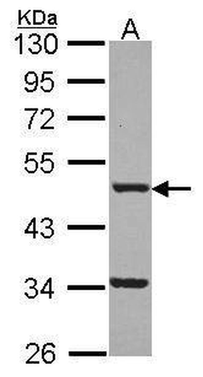 FNTB Antibody in Western Blot (WB)