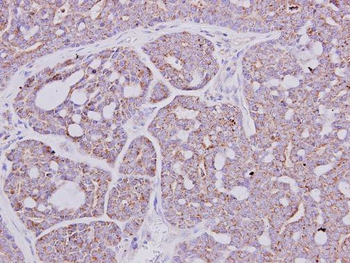 GART Antibody in Immunohistochemistry (Paraffin) (IHC (P))