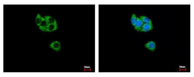 GCDH Antibody in Immunocytochemistry (ICC/IF)