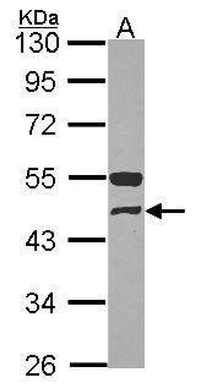 GCDH Antibody in Western Blot (WB)