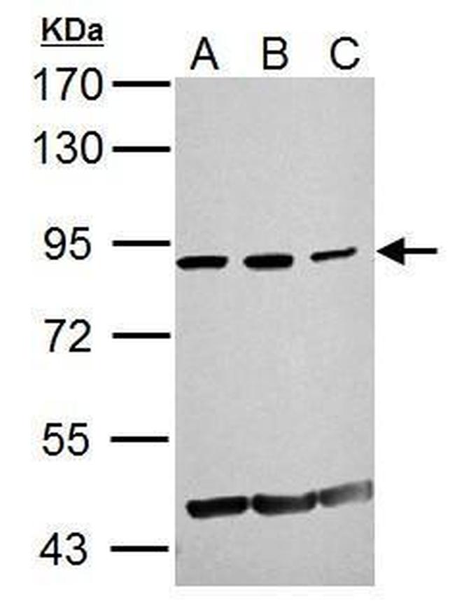 GCN5 Antibody in Western Blot (WB)