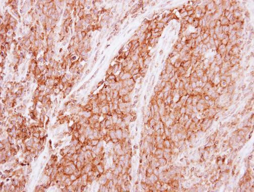 GNB1 Antibody in Immunohistochemistry (Paraffin) (IHC (P))