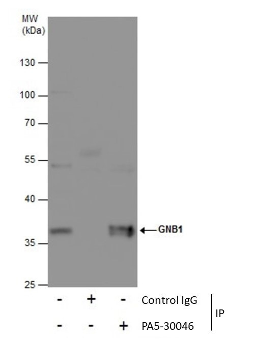 GNB1 Antibody in Immunoprecipitation (IP)