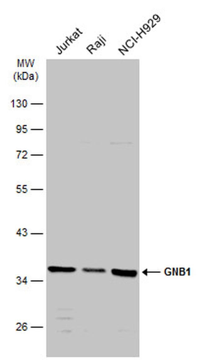 GNB1 Antibody in Western Blot (WB)